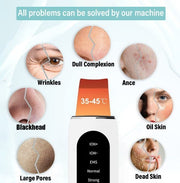 Shovel Skin Blackhead Ultrasonic Beauty Microcurrent Color Light